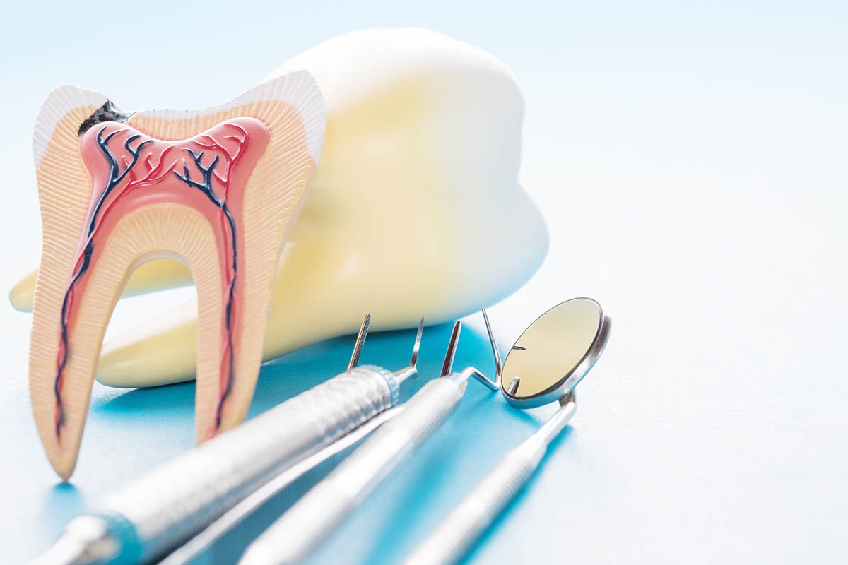 The Difference Between Endodontics and Dentistry AccessEndo